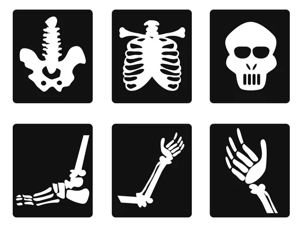 Iconos de rayos X — Archivo Imágenes Vectoriales