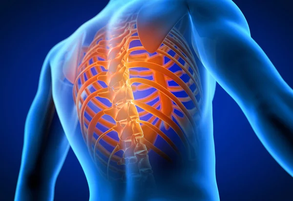 3D对一个背痛的男人进行了精确的医学描述 — 图库照片