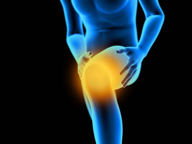 3d rendered medically accurate illustration of a man having a painful knee clipart