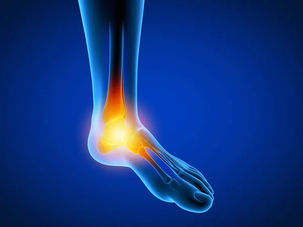 3Dは痛みを伴う足を持つ男の医学的に正確なイラストをレンダリングしました — ストック写真