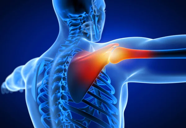 3d rendered medically accurate illustration of a man having a painful shoulder — Stock Photo, Image