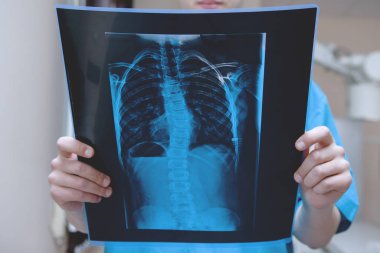 Erkek doktor radyoloji uzmanı bir muayenehanede röntgenleri inceliyor..