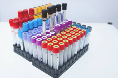 Laboratuvar araştırmaları için rafta kan örnekleri içeren test tüpleri.