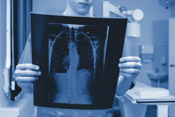 Radiologe Mannelijke Arts Onderzoekt Röntgenfoto Een Medisch Kantoor — Stockfoto