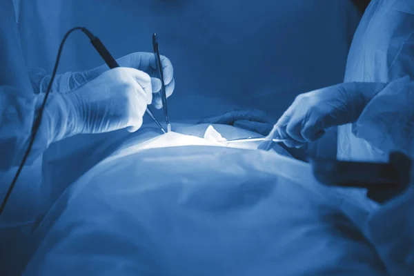 Mãos Cirurgião Durante Operação Luvas Látex Uniforme Azul Dos Médicos — Fotografia de Stock