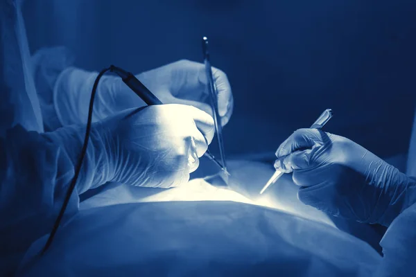 Mani Del Chirurgo Durante Operazione Guanti Lattice Uniforme Blu Dei — Foto Stock