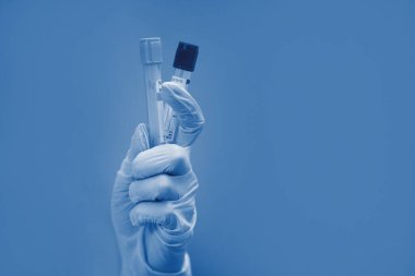 Bir hemşirenin elinde lateks eldivenle koronavirüs testi yapılan test tüpü..