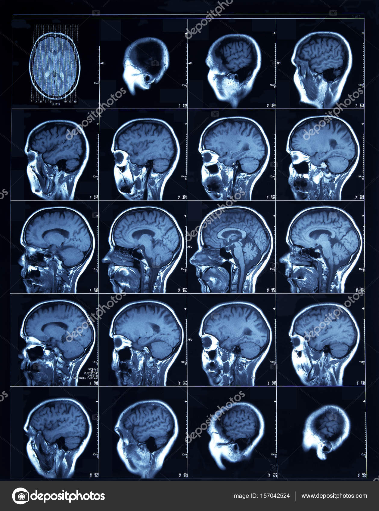 CT scan of an adult human Stock Photo rixipix 157042524 Biology Diagrams