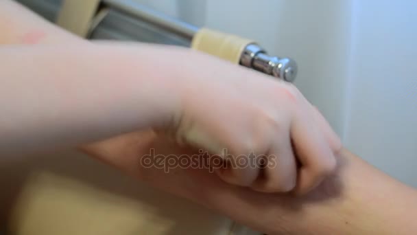 Kind met een uitslag van acute urticaria krabben hand — Stockvideo