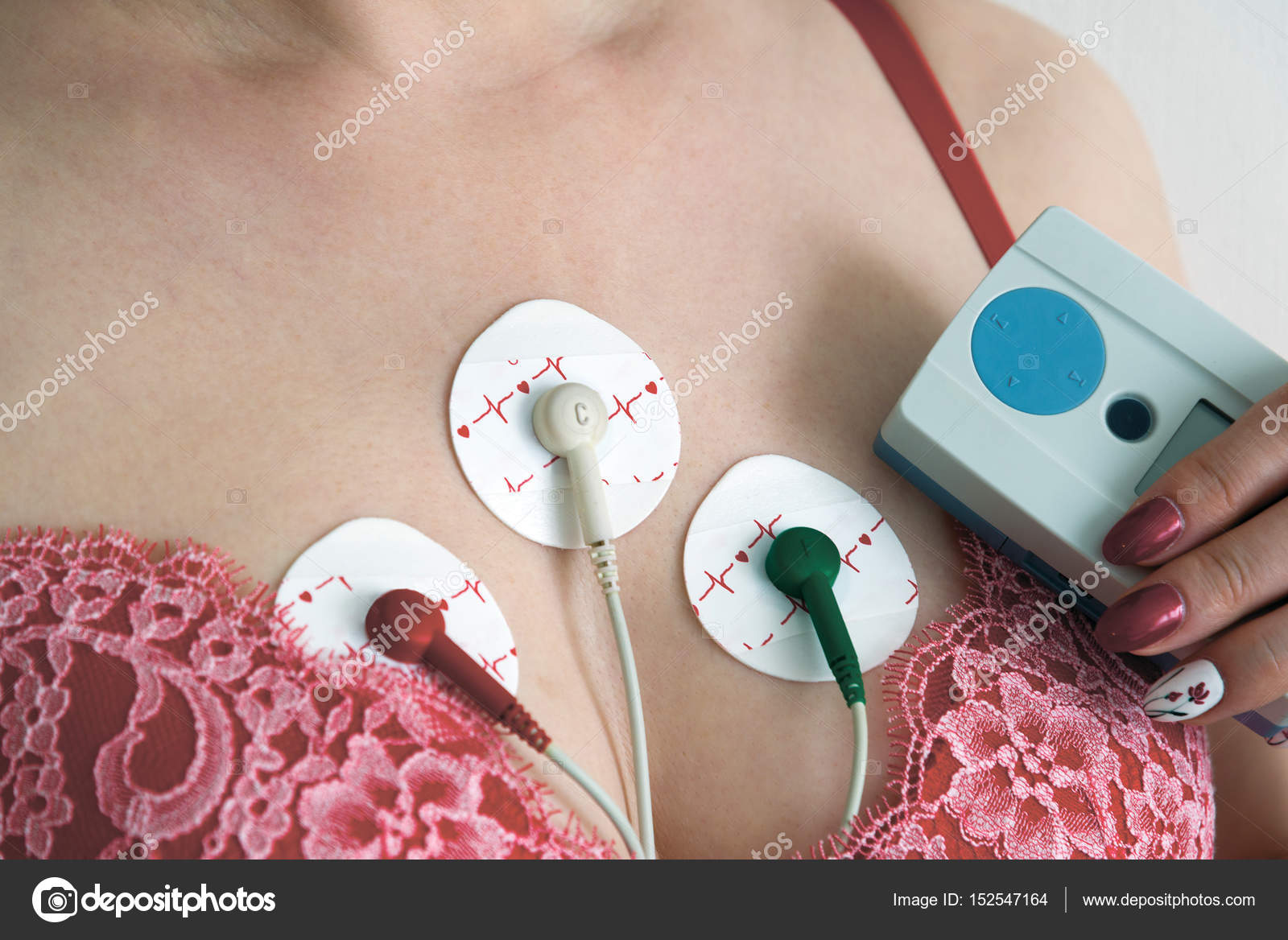 Electrodes Holter monitoring on the chest of woman Stock Photo by
