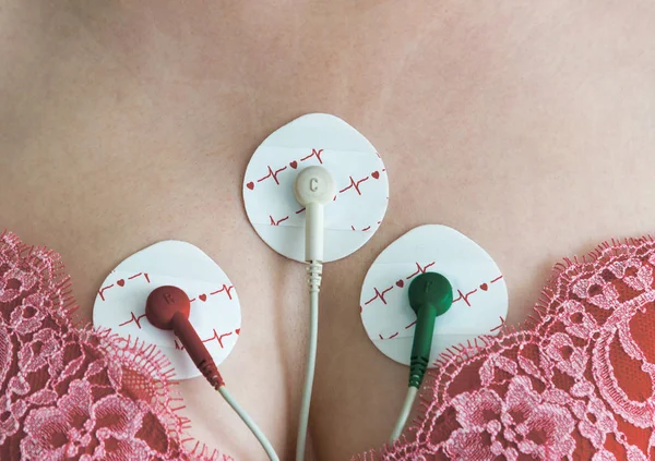 Eletrodos Holter monitoramento no peito da mulher — Fotografia de Stock