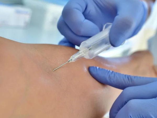 Doctor takes blood from a vein for analysis — Stock Photo, Image