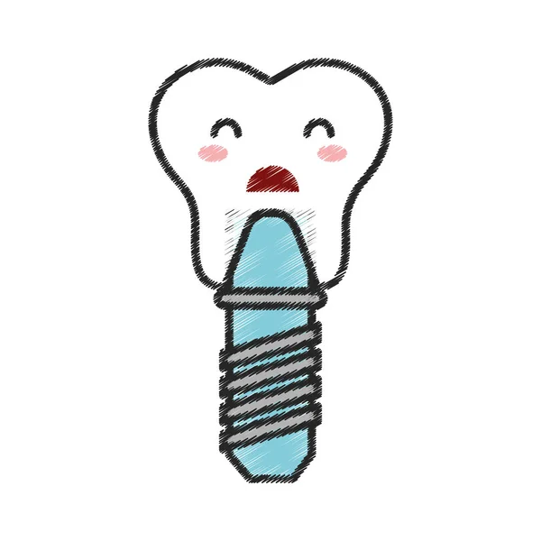 Symbolfigur für Zahnimplantate — Stockvektor