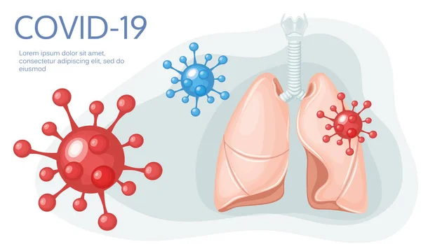 Pulmones humanos. Enfermedad de Sars, coronavirus en el pulmón. Coronavirus . — Archivo Imágenes Vectoriales