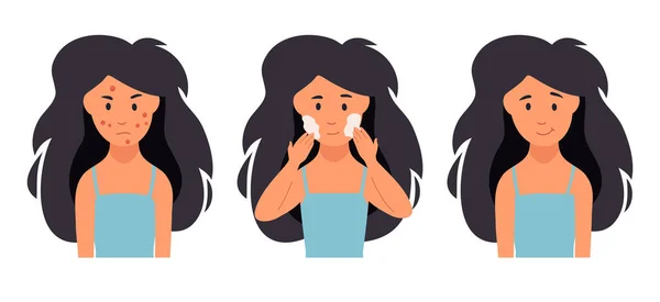 Acne treatment. Unhappy girl struggling with acne,pimples. — Stock Vector