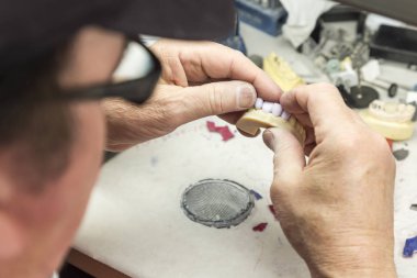 İmplantlar diş diş için 3d yazdırılan kalıp üzerinde çalışan teknisyeni