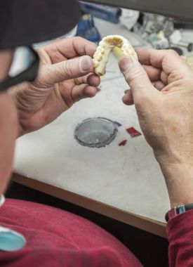 Dental Technician Working On 3D Printed Mold For Tooth Implants clipart