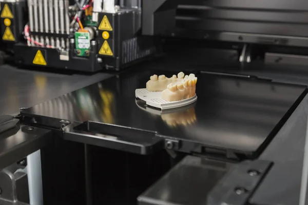 Impresora 3D con acabado 3D Impreso puente de implante dental — Foto de Stock
