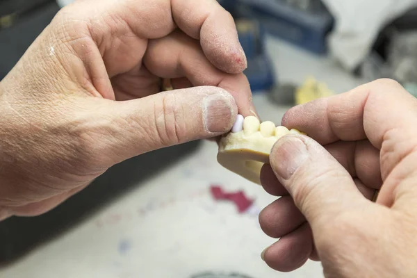 Técnico odontológico trabalhando no molde impresso em 3D para implantes dentários — Fotografia de Stock