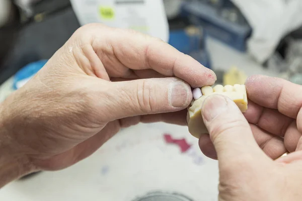 Técnico odontológico trabalhando no molde impresso em 3D para implantes dentários — Fotografia de Stock