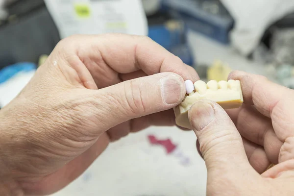 Tandtechnicus werken op 3D-gedrukte mal om tand implantaten — Stockfoto