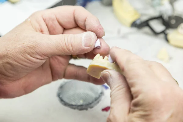Tandtechnicus werken op 3D-gedrukte mal om tand implantaten — Stockfoto