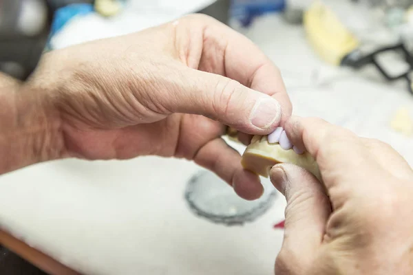 Dental Technician Working On 3D Printed Mold For Tooth Implants — Stock Photo, Image