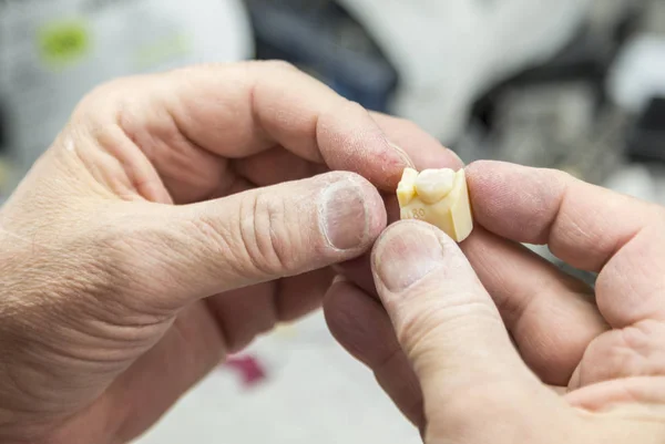 Técnico odontológico trabalhando no molde impresso em 3D para implantes dentários — Fotografia de Stock