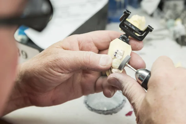 Technik dentystyczny praca na 3d formy drukowanej dla zębów implanty — Zdjęcie stockowe
