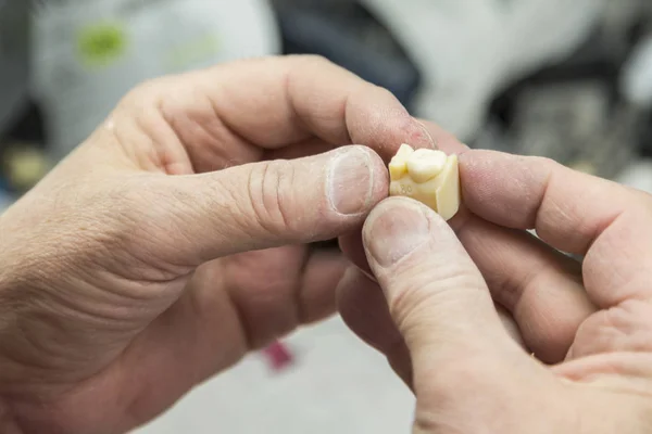 Técnico odontológico trabalhando no molde impresso em 3D para implantes dentários — Fotografia de Stock