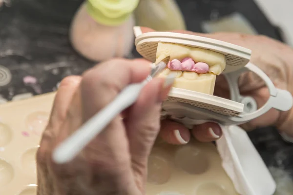 Technik dentystyczny, stosowanie porcelany do 3d formy drukowanej implantu — Zdjęcie stockowe