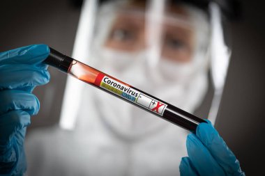 Kadın Labaratuar İşçisi Kan Etiketli Coronavirüs COVID-19 Hastalığının Test Tüpünü Tutuyor.