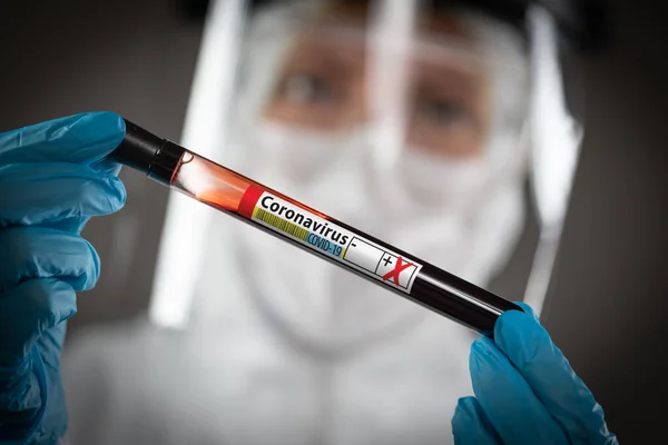 Vrouwelijke Lab Werknemer Houdt Reageerbuis Van Bloed Gelabeld Coronavirus Covid — Stockfoto