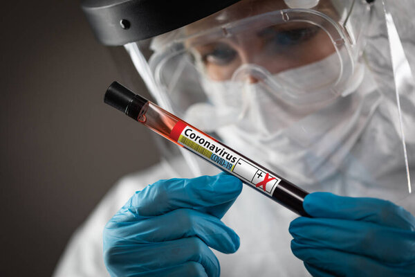 Female Lab Worker Holds Test Tube of Blood Labeled Coronavirus COVID-19 Disease.