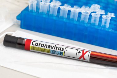 Laboratuar masasında yatan pozitif Coronavirus Kan Test Tüpü.