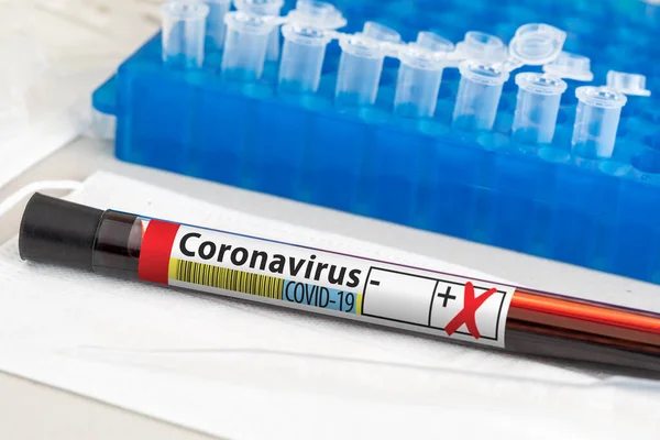 Pozitív Coronavirus Blood Test Tube Feküdt Laboratóriumi Táblázat — Stock Fotó