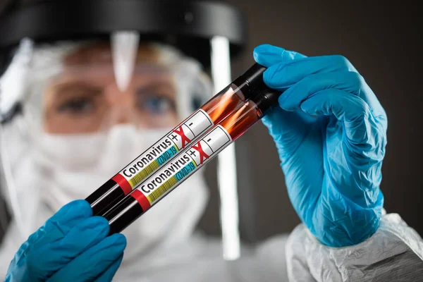 Médica Enfermeira Segurando Tubos Teste Sangue Positivo Para Coronavírus Covid — Fotografia de Stock