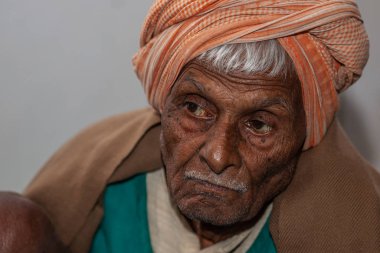 Sundarpur, Hindistan - 2013: Tanımlanamayan Hintli cüzzam hastası 