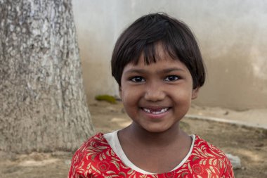 Sundarpur, Hindistan - 2013: Hindistan 'ın Bihar eyaletindeki yerel cüzzam hastanesinde kimliği belirsiz Hintli çocuklar