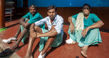 Sundarpur, Hindistan - 2013: Hindistan 'ın Bihar eyaletindeki yerel bir cüzzamlı hastanesinde kimliği belirsiz Hintli cüzzamlı hastalar