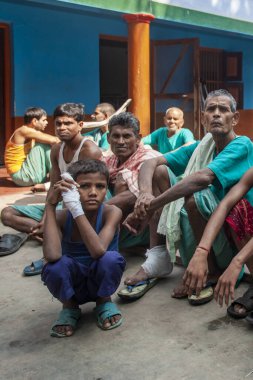 Sundarpur, Hindistan - 2013: Hindistan 'ın Bihar eyaletindeki yerel bir cüzzamlı hastanesinde kimliği belirsiz Hintli cüzzamlı hastalar