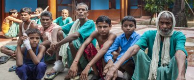 Sundarpur, Hindistan - 2013: Hindistan 'ın Bihar eyaletindeki yerel bir cüzzamlı hastanesinde kimliği belirsiz Hintli cüzzamlı hastalar