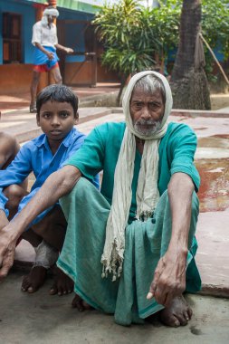 Sundarpur, Hindistan - 2013: Hindistan 'ın Bihar eyaletindeki yerel bir cüzzamlı hastanesinde kimliği belirsiz Hintli cüzzamlı hastalar