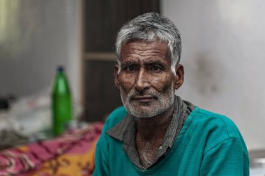 Sundarpur, Hindistan - 2013: Hindistan 'ın Bihar eyaletindeki yerel bir cüzzamlı hastanesinde kimliği belirsiz Hintli cüzzamlı hastalar