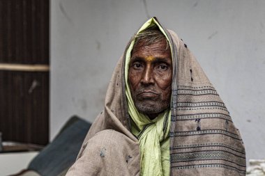 Sundarpur, Hindistan - 2013: Hindistan 'ın Bihar eyaletindeki yerel bir cüzzamlı hastanesinde kimliği belirsiz Hintli cüzzamlı hastalar