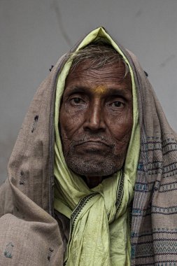 Sundarpur, Hindistan - 2013: Hindistan 'ın Bihar eyaletindeki yerel bir cüzzamlı hastanesinde kimliği belirsiz Hintli cüzzamlı hastalar