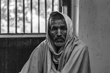 Sundarpur, Hindistan - 2013: Hindistan 'ın Bihar eyaletindeki yerel bir cüzzamlı hastanesinde kimliği belirsiz Hintli cüzzamlı hastalar