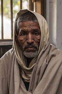 Sundarpur, Hindistan - 2013: Hindistan 'ın Bihar eyaletindeki yerel bir cüzzamlı hastanesinde kimliği belirsiz Hintli cüzzamlı hastalar