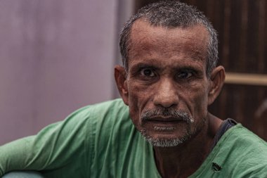 Sundarpur, Hindistan - 2013: Hindistan 'ın Bihar eyaletindeki yerel bir cüzzamlı hastanesinde kimliği belirsiz Hintli cüzzamlı hastalar