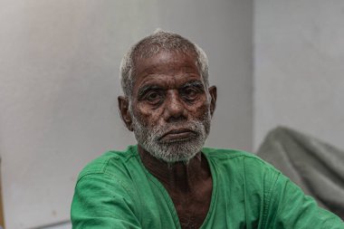 Sundarpur, Hindistan - 2013: Hindistan 'ın Bihar eyaletindeki yerel bir cüzzamlı hastanesinde kimliği belirsiz Hintli cüzzamlı hastalar